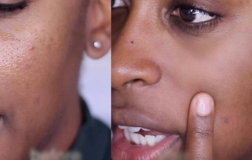 Jackie Aina shows a 'before' enlarged and 'after' minimized pores
