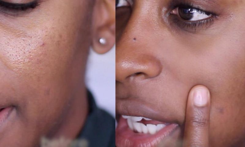 Jackie Aina shows a 'before' enlarged and 'after' minimized pores