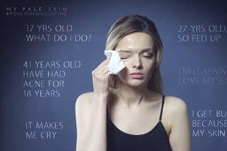 Em Ford, blogger at My Pale Skin