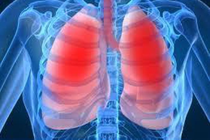 ___3895372___https:______static.pulse.com.gh___webservice___escenic___binary___3895372___2015___6___22___15___images