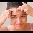 Forehead acne