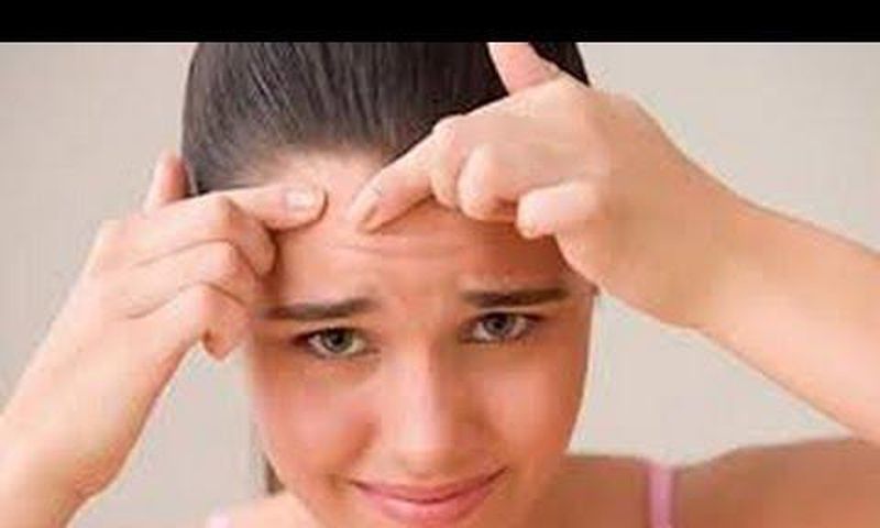 Forehead acne