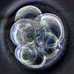 Trial over fate of frozen embryos underway in San Francisco