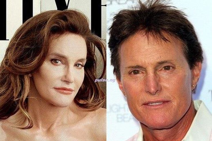 Caitlyn vs Bruce Jenner