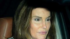 Transgender, Caitlyn Jenner, admits to removing her beards back in the 80's
