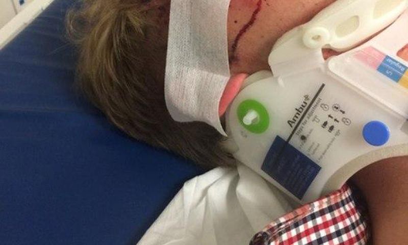 Dalton Gray's eye under treatment by doctors