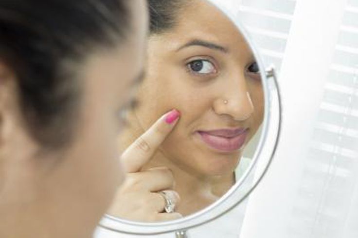 Preventing skin breakouts