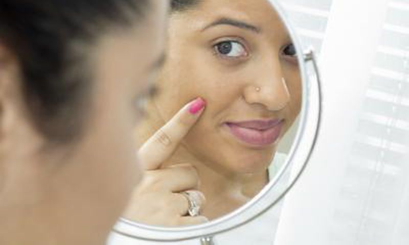 Preventing skin breakouts