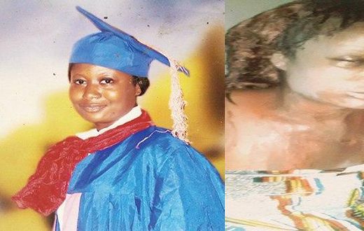 Rosemary Nanaifa (Before and after)