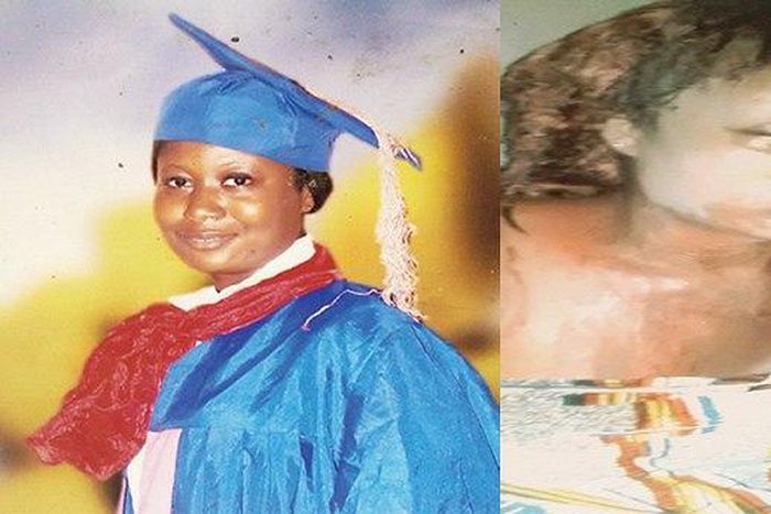 Rosemary Nanaifa (Before and after)