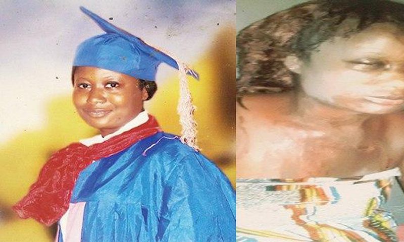Rosemary Nanaifa (Before and after)
