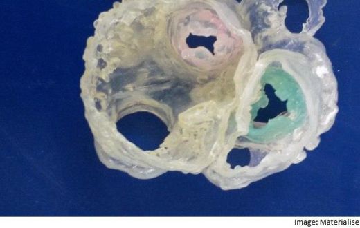 Image of the first ever heart 3D-Printed using multiple imaging techniques