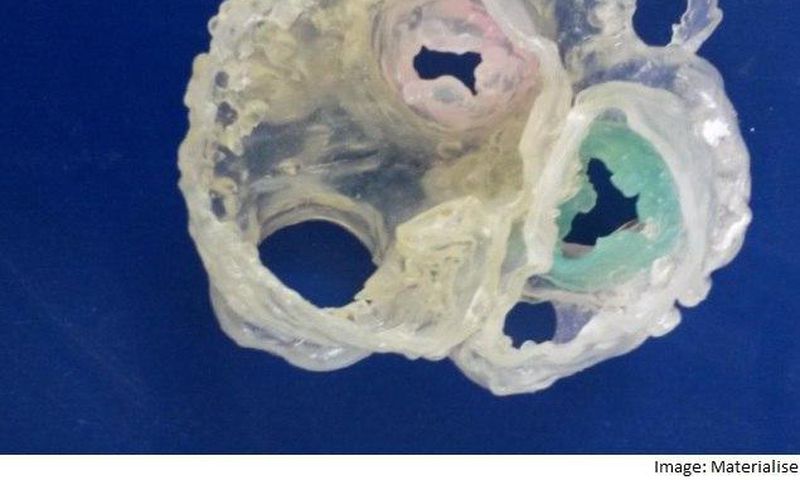 Image of the first ever heart 3D-Printed using multiple imaging techniques