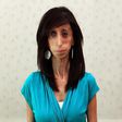 Lizzie Velasquez