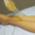 Sugaring method of hair removal