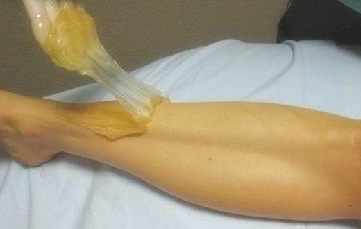 Sugaring method of hair removal