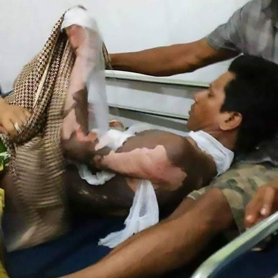 Woman burns husband alive for refusing to disclose his phone’s password