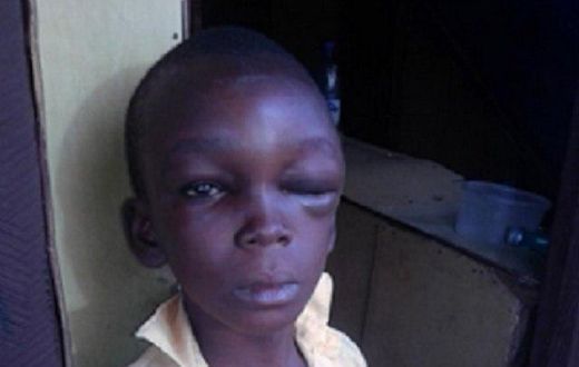 The brutalised boy