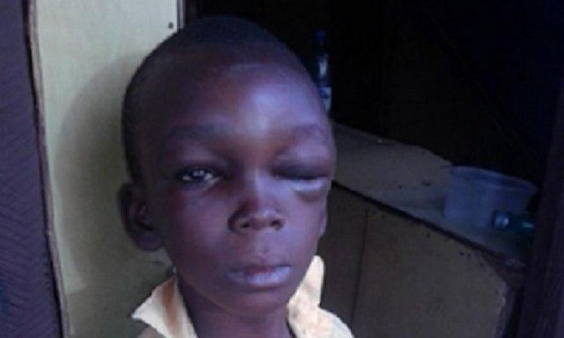The brutalised boy