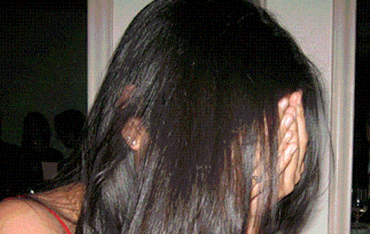 Dubai prostitute burns client for not paying