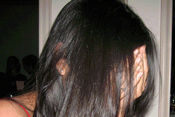 Dubai prostitute burns client for not paying