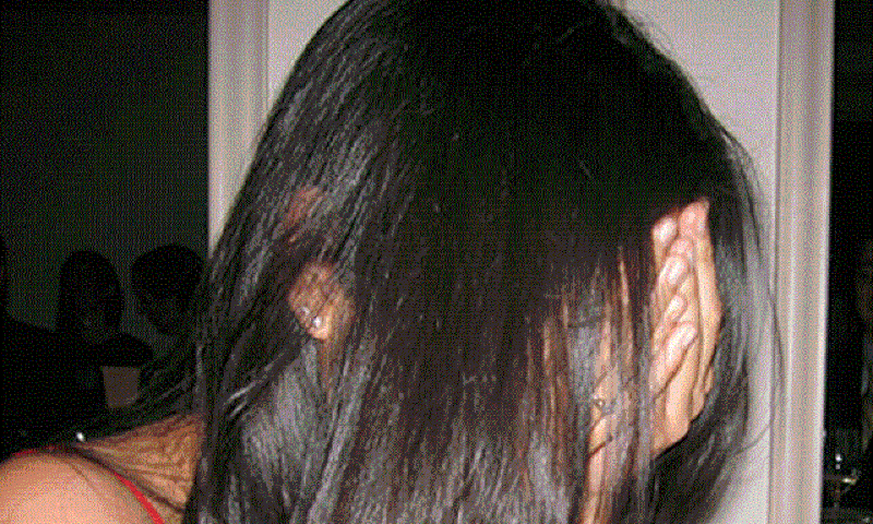 Dubai prostitute burns client for not paying