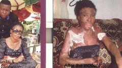 Isaac Gbarwuan and wife Mary Sunday before and after