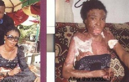 Isaac Gbarwuan and wife Mary Sunday before and after
