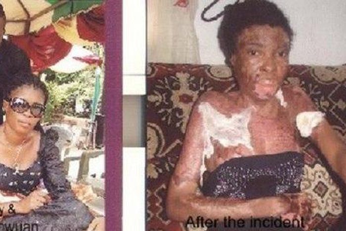 Isaac Gbarwuan and wife Mary Sunday before and after