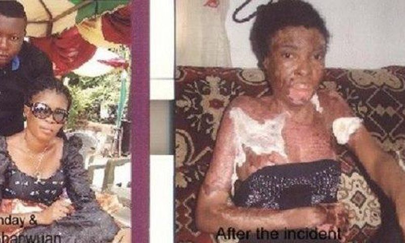 Isaac Gbarwuan and wife Mary Sunday before and after