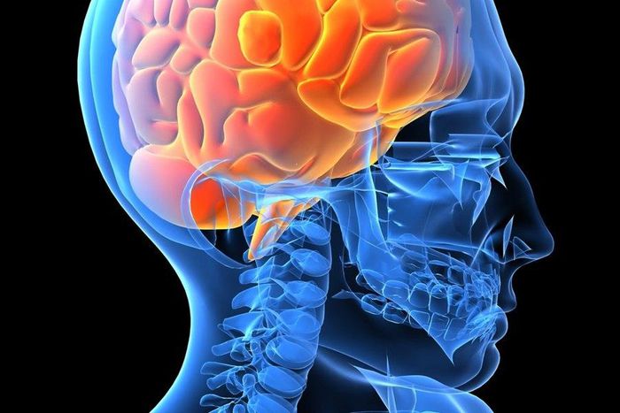 ___3877738___https:______static.pulse.com.gh___webservice___escenic___binary___3877738___2015___6___17___19___Brain_0