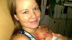 Meet the baby born without a skull and brain, Jaxon Buell
