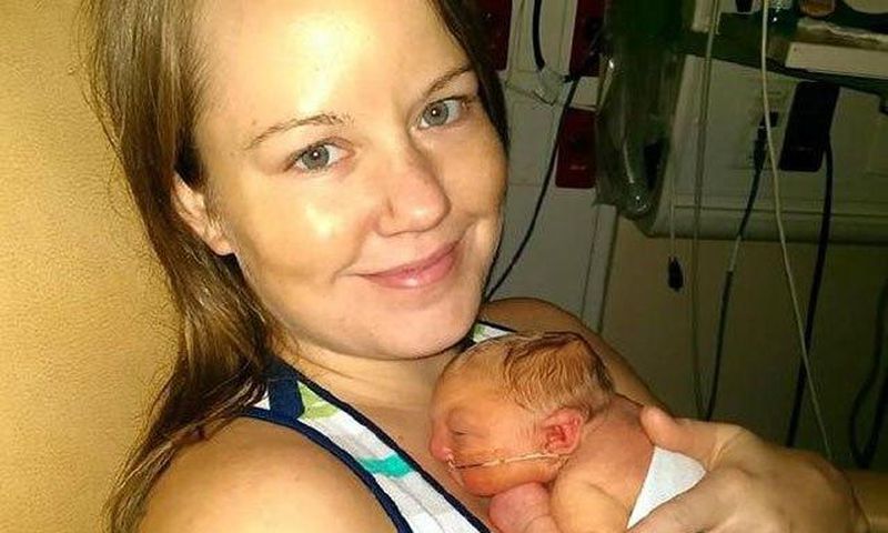 Meet the baby born without a skull and brain, Jaxon Buell