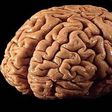 ___3816664___https:______static.pulse.com.gh___webservice___escenic___binary___3816664___2015___6___1___13___Things-must-be-known-about-brain-cancer