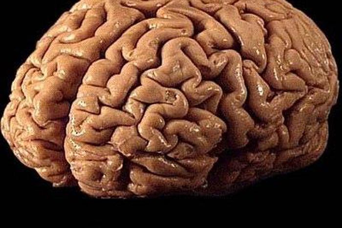 ___3816664___https:______static.pulse.com.gh___webservice___escenic___binary___3816664___2015___6___1___13___Things-must-be-known-about-brain-cancer