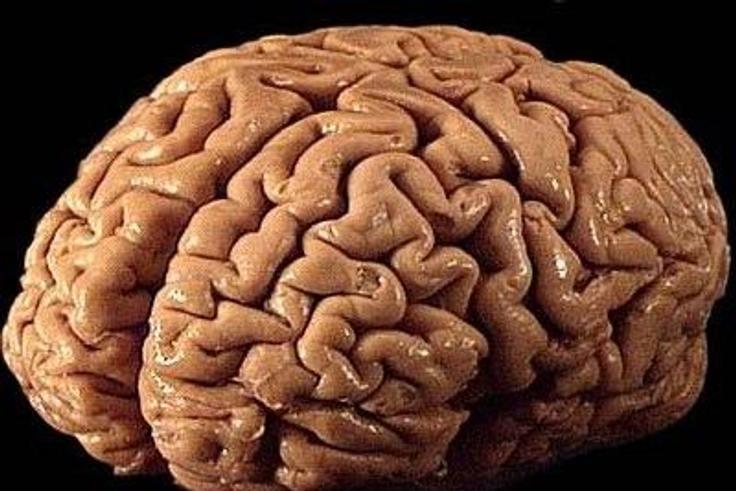 ___3816664___https:______static.pulse.com.gh___webservice___escenic___binary___3816664___2015___6___1___13___Things-must-be-known-about-brain-cancer