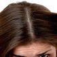 Dry, flaky scalp