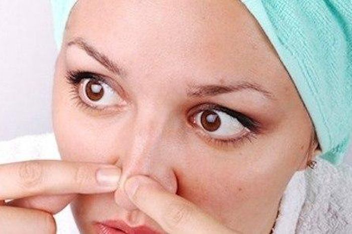 Home remedies work to remove blackheads