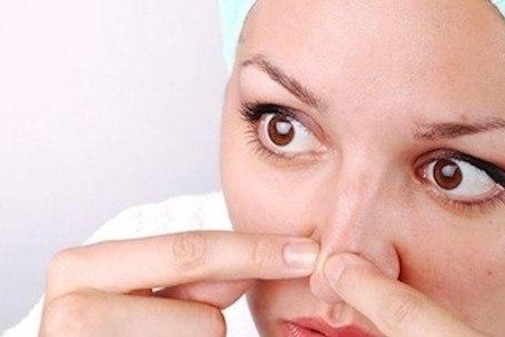 Home remedies work to remove blackheads