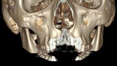 ___4231844___https:______static.pulse.com.gh___webservice___escenic___binary___4231844___2015___10___5___18___tumblr_inline_nn4diiwuon1qzgziy_400