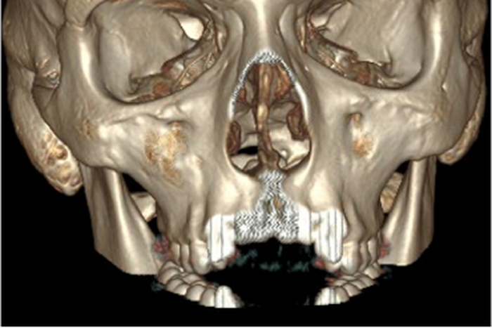 ___4231844___https:______static.pulse.com.gh___webservice___escenic___binary___4231844___2015___10___5___18___tumblr_inline_nn4diiwuon1qzgziy_400