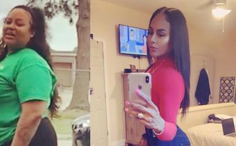 'I Lost 145 Pounds On The Keto Diet'