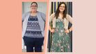 'I Lost 336 Pounds And Had Loose Skin Removed'