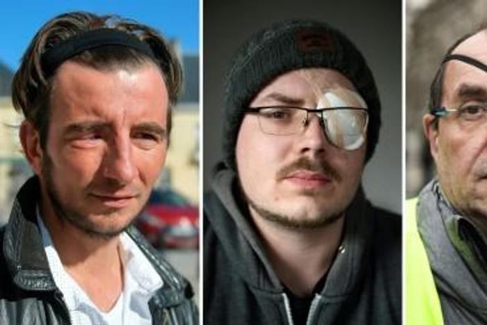 In addition to those partially blinded during "yellow vest" protests who are quoted in this story are Gwendal Leroy and Patrick Galliand (second and third from left)