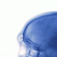 What to Do When You Hit Your Head Really Hard