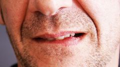 How To Get Rid of a Pimple On Your Lip