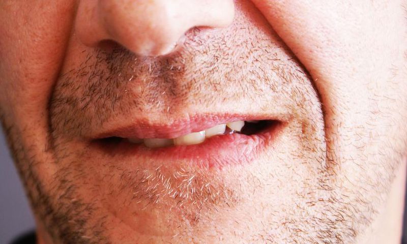 How To Get Rid of a Pimple On Your Lip