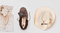 What It's Like to be Struck By Lightning