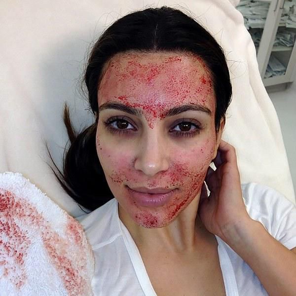 Facial mask