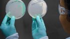 How a Chicago Woman Fell Victim to Candida Auris, a Drug-Resistant Fungus